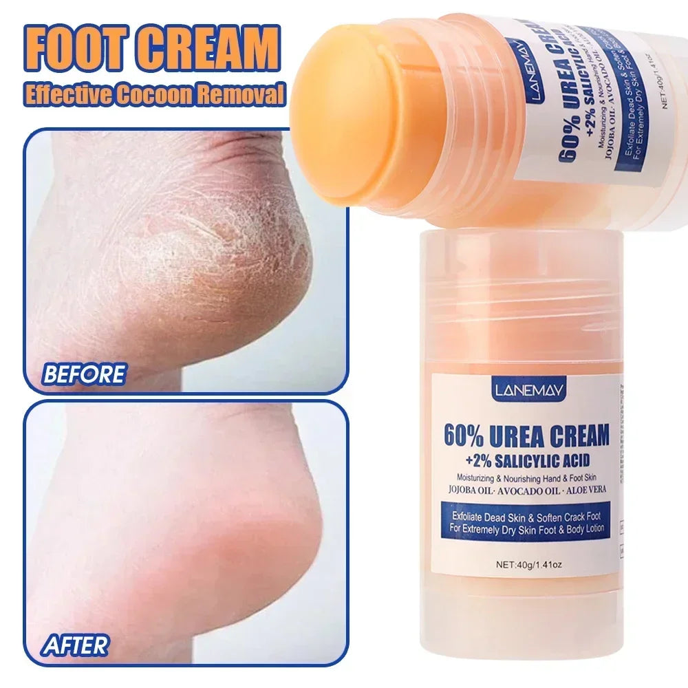 Crème Hydratante en Profondeur pour les Pieds Secs et Craquelés, Talon, Doux, Adoucissant la Peau, Fruité, Soins des Mains et des Pieds, Outils en Bâton, 40g
