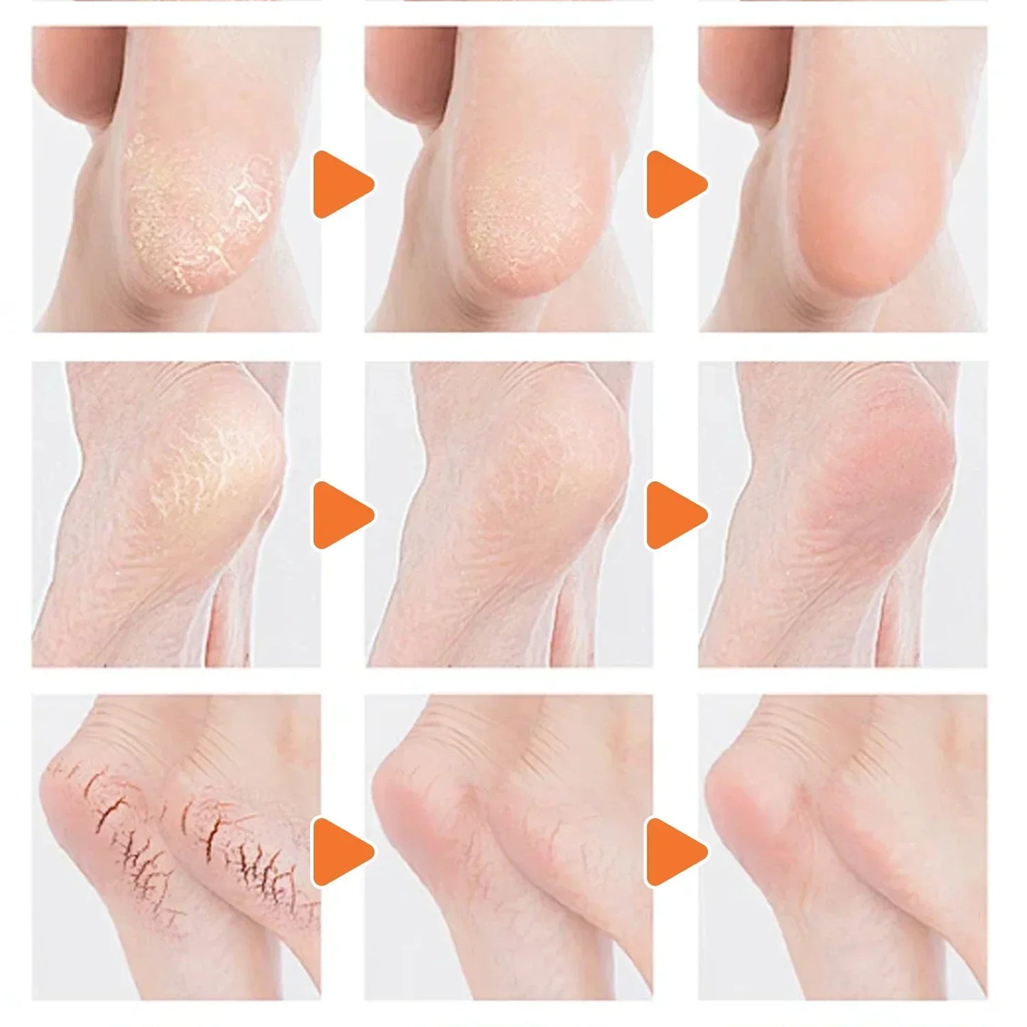 Crème Hydratante en Profondeur pour les Pieds Secs et Craquelés, Talon, Doux, Adoucissant la Peau, Fruité, Soins des Mains et des Pieds, Outils en Bâton, 40g