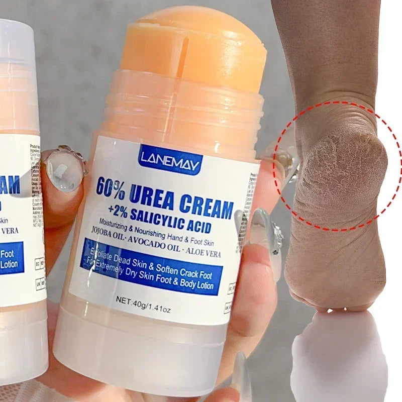 Crème Hydratante en Profondeur pour les Pieds Secs et Craquelés, Talon, Doux, Adoucissant la Peau, Fruité, Soins des Mains et des Pieds, Outils en Bâton, 40g